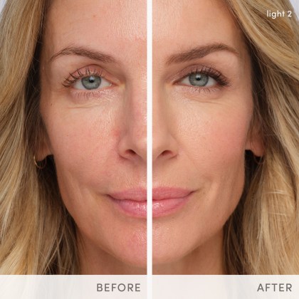 HydroPureTintedSerum_before-and-after-svetlana