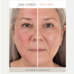 After Glow To-Go Post-Treatment Kit - Image 5