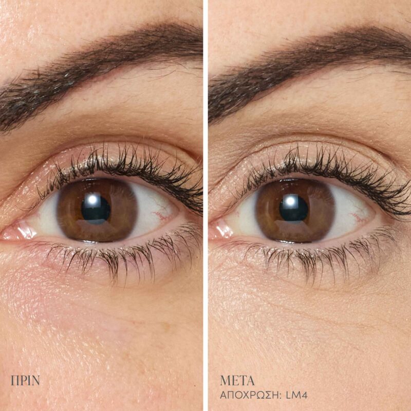 LM4_Main_Editable_BAs