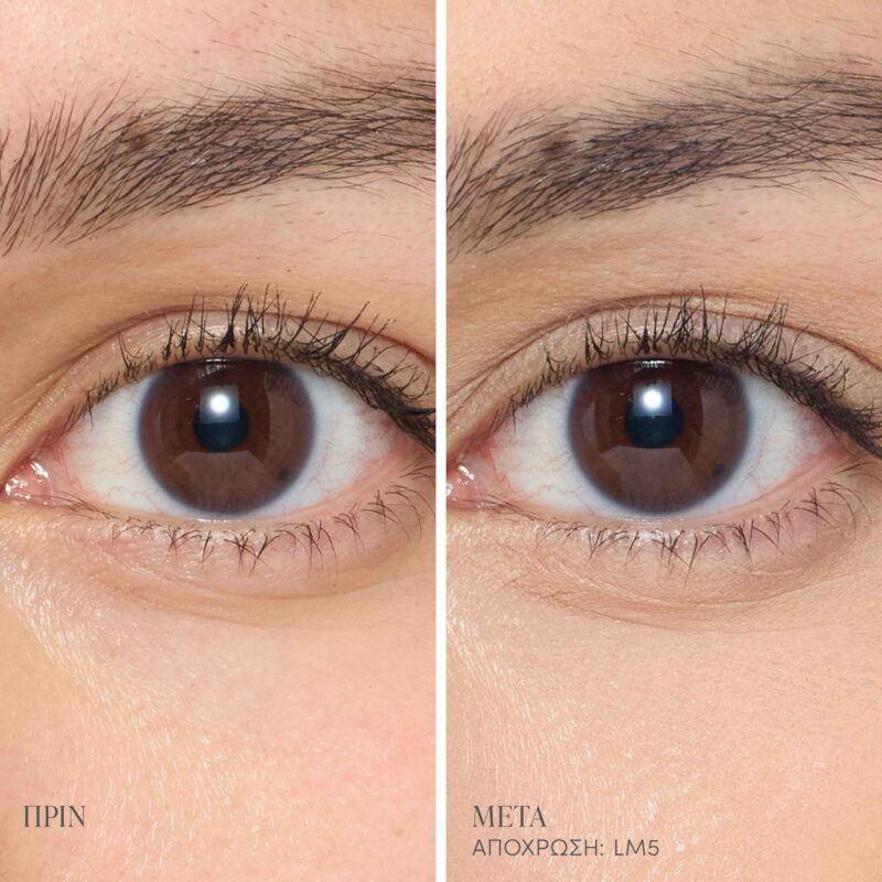 LM5_Main_Editable_BAs