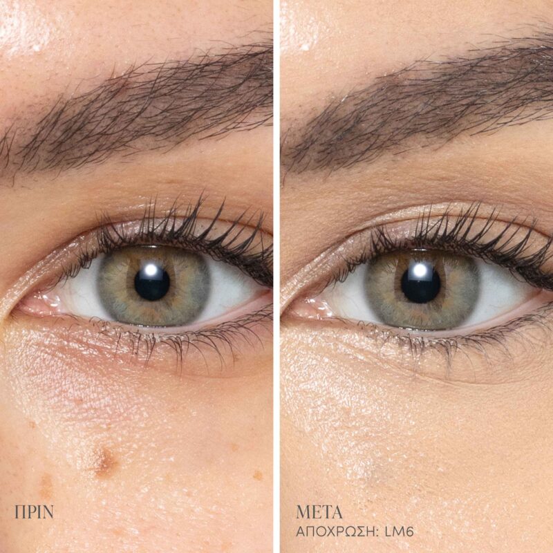 LM6_Main_Editable_BAs (1)